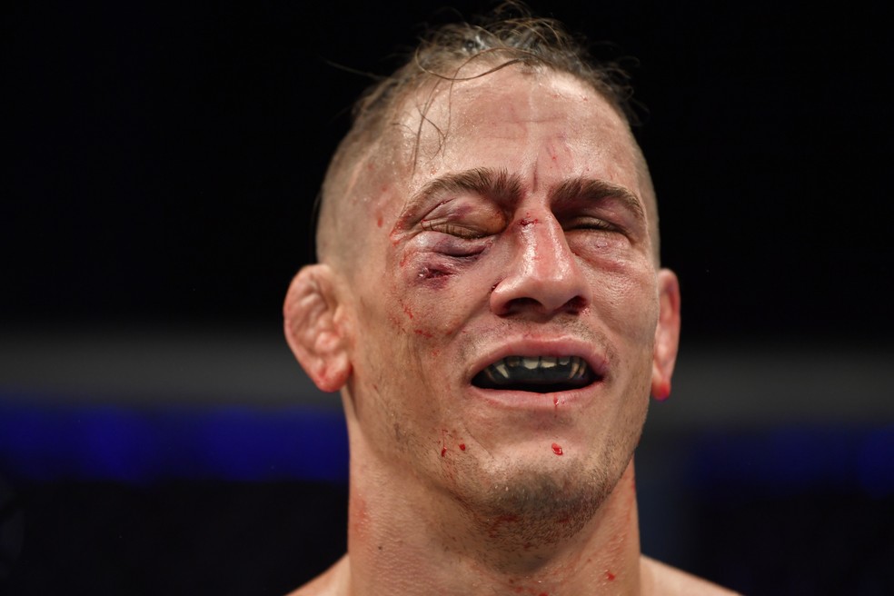 Niko Price ficou com o rosto avariado após a derrota para Vicente Luque — Foto: Getty Images