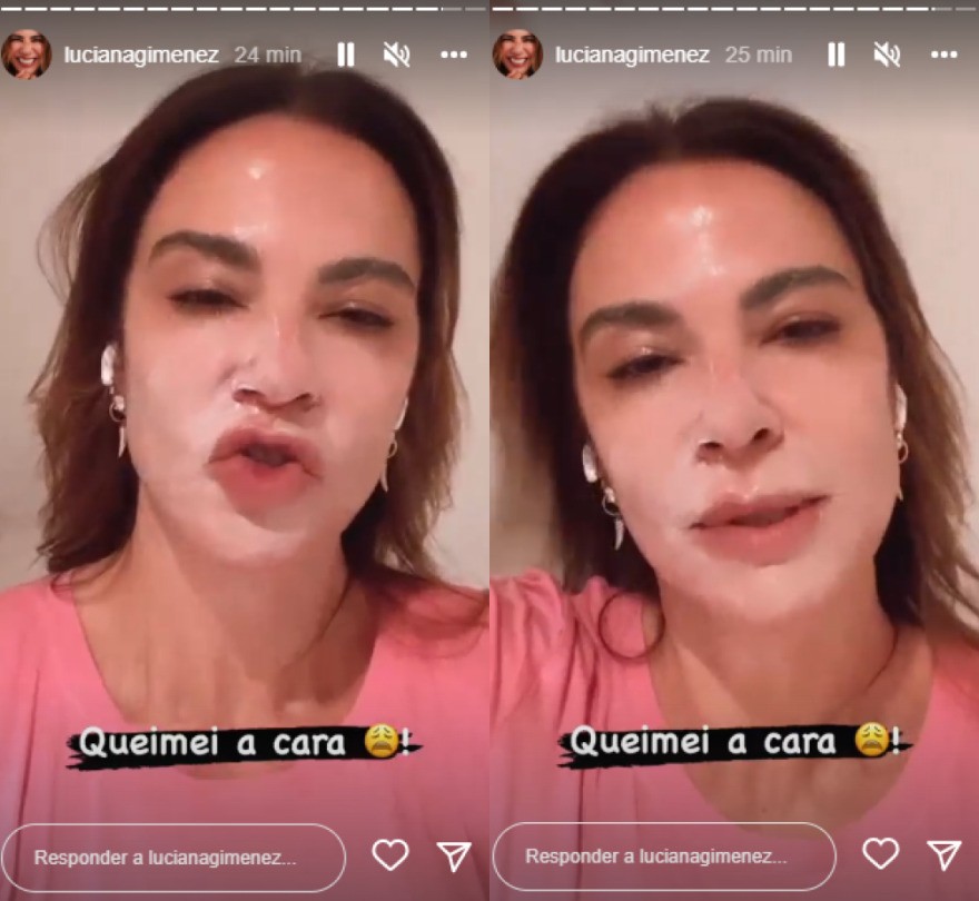 Luciana Gimenez diz ter sofrido queimadura no rosto (Foto: Reprodução/Instagram)
