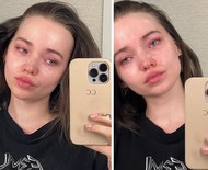Dove Cameron, atriz ex-Disney, preocupa fãs em selfies chorando e abre o jogo sobre luta contra depressão e disforia