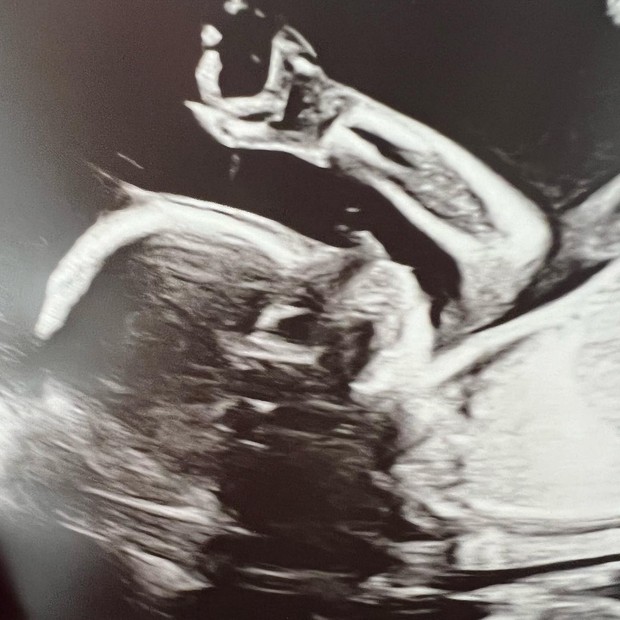 Hilaria Baldwin mostra ultrassom de seu sétimo filho com Alec Baldwin (Foto: Reprodução/Instagram)