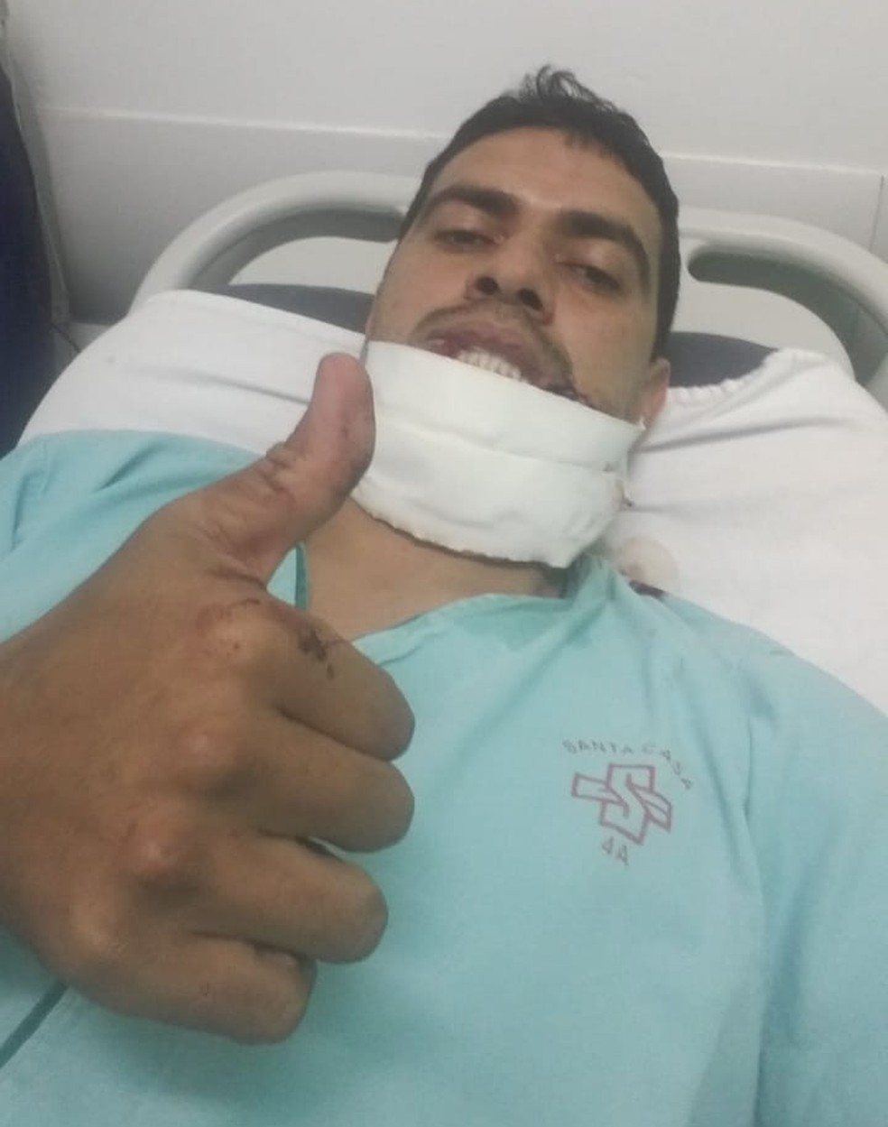 Policial foi atacado por cão pitbull ao tentar guardar animal na casa do vizinho, diz esposa da vítima — Foto: Reprodução/WhatsApp