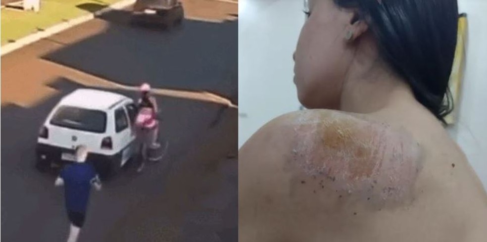 Vítima ficou ralada e com hematoma na perna após acidente, em Palmas — Foto: Câmera de monitoramento/Arquivo pessoal