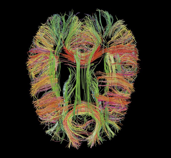 AQUI TEM 1,1 BILHÃO DE TERABYTES > Imagens como essa, feitas pelo Human Connectome Project, estão ajudando a digitalizar o cérebro (Foto: Divulgação)
