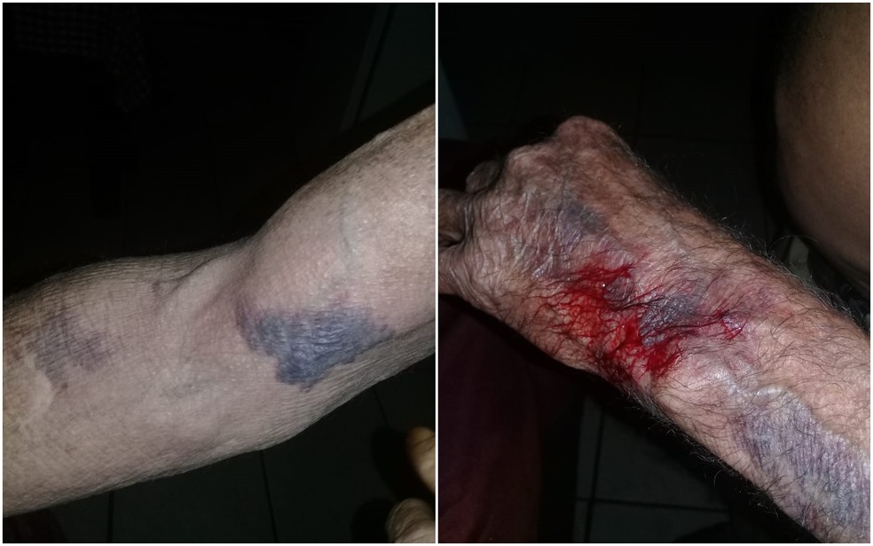 Idosos tinham várias lesões pelo corpo e foram resgatados pela PM, em Aparecida de Goiânia — Foto: Polícia Militar/Divulgação 