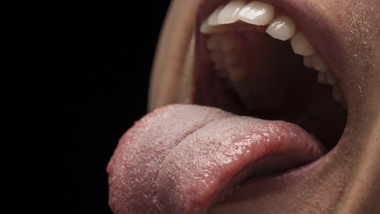 Os 5 melhores exercícios com a língua para parar de roncar