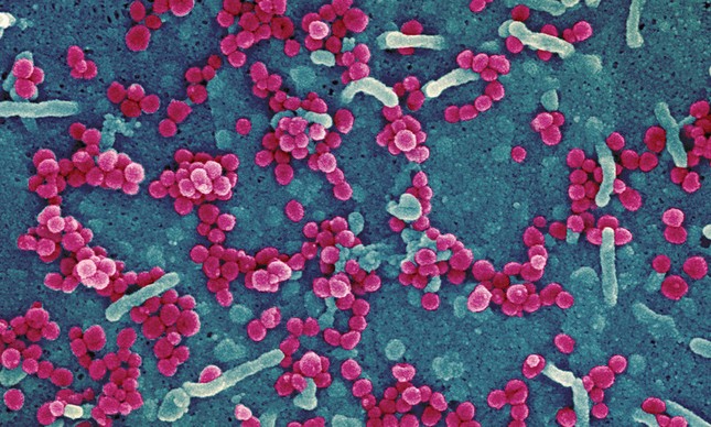 Superbactérias: total de pacientes infectados com bactérias multi-R triplicou no Brasil durante a pandemia de Covid-19