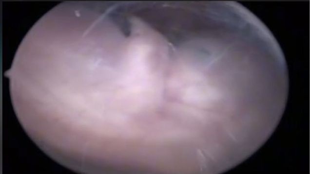 Imagem rara do feto de dez semanas (Foto: Reprodução/TikTok)