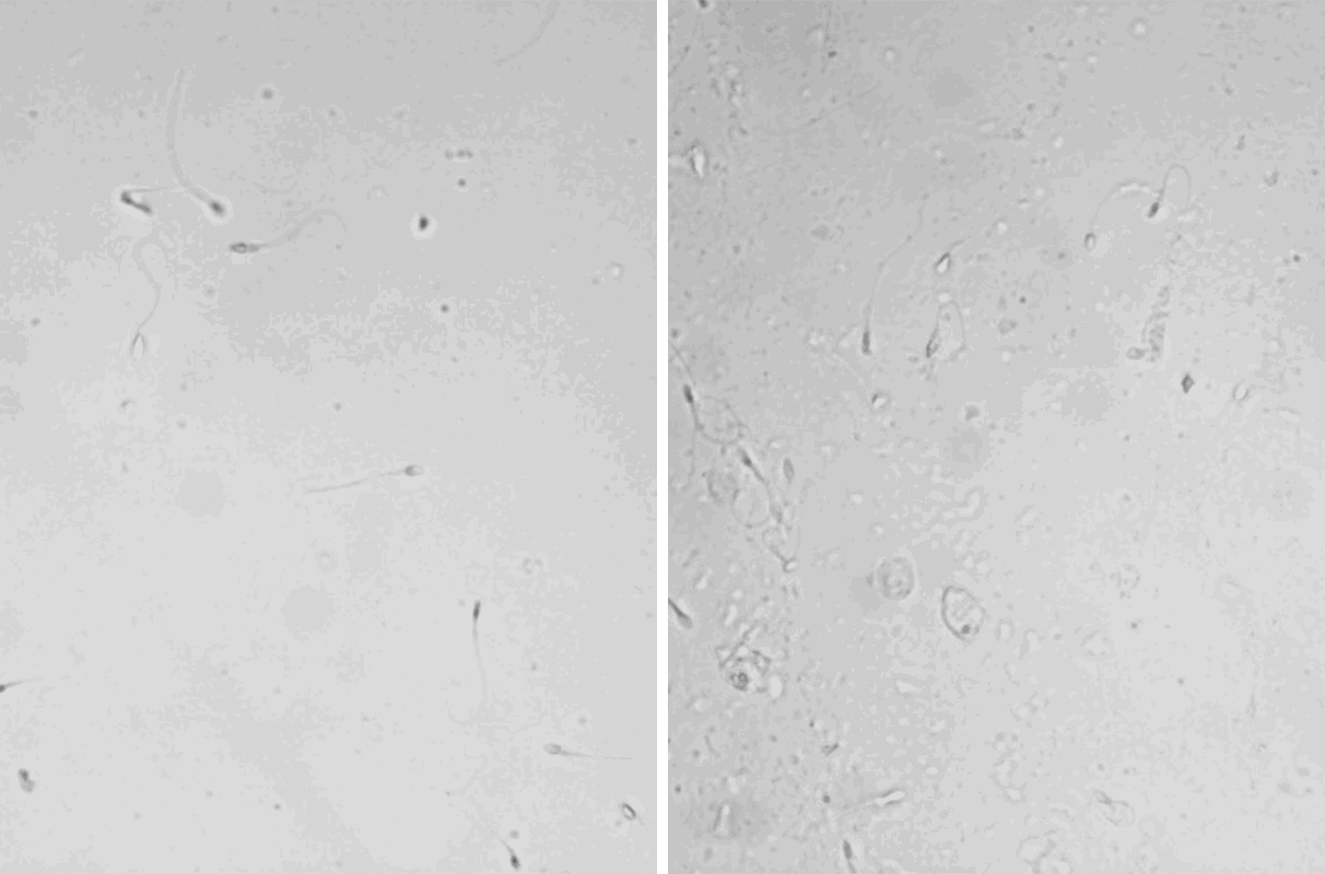 Uma amostra de controle de sêmen humano (esquerda) e uma tratada com AEBSF para bloquear a liquefação do sêmen (direita) (Foto: Washington State University)