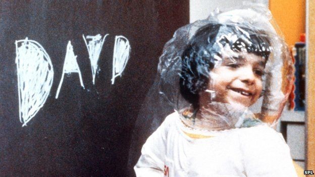 David Vetter ficou conhecido na década de 1970 como o 'menino bolha' (Foto: SPL via BBC News Brasil)
