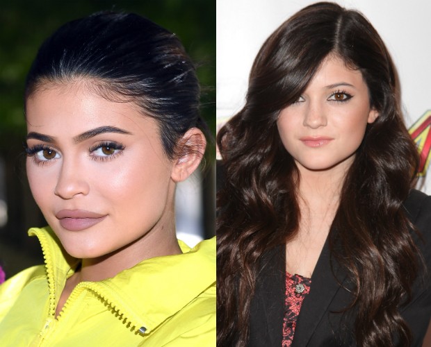 Kylie Jenner em 2018 (esquerda) e em 2010, antes dos procedimentos estéticos (direita) (Foto: Getty)