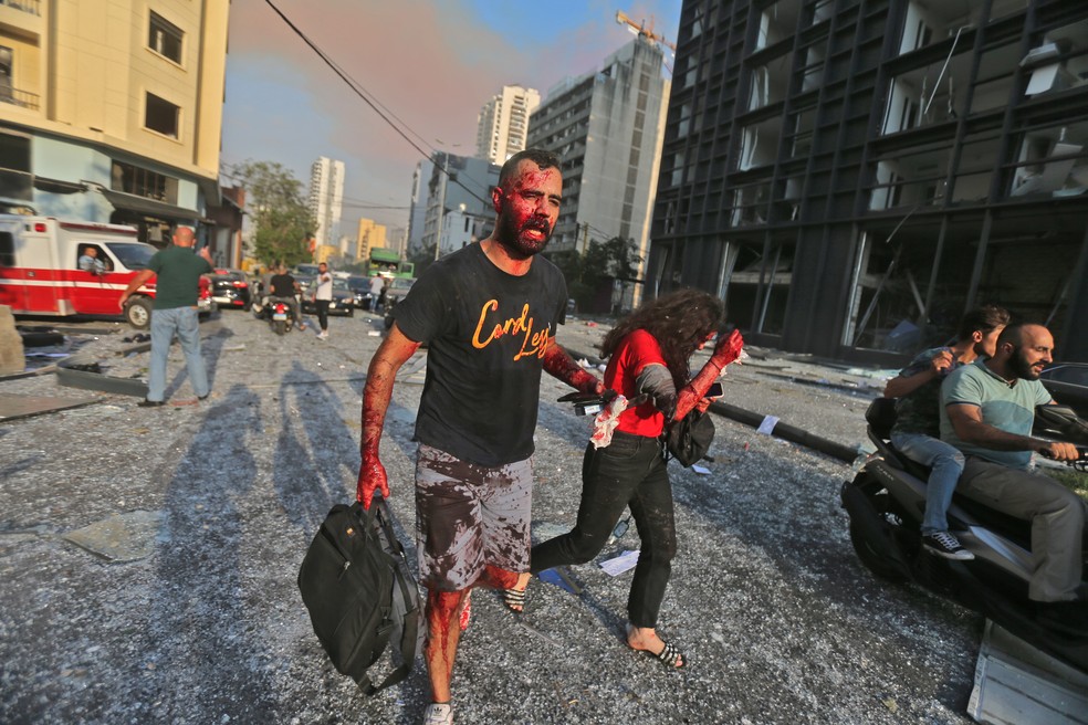 Feridos na explosão na zona portuária de Beirute, no Líbano — Foto: STR/AFP