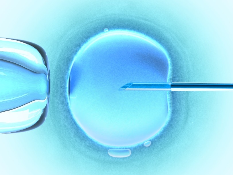 Fertilização in vitro (Foto: Getty Images)