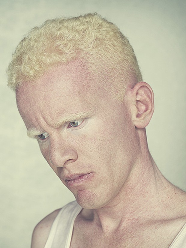 Fotos livro Albinos (Foto: Gustavo Lacerda/Divulgação)