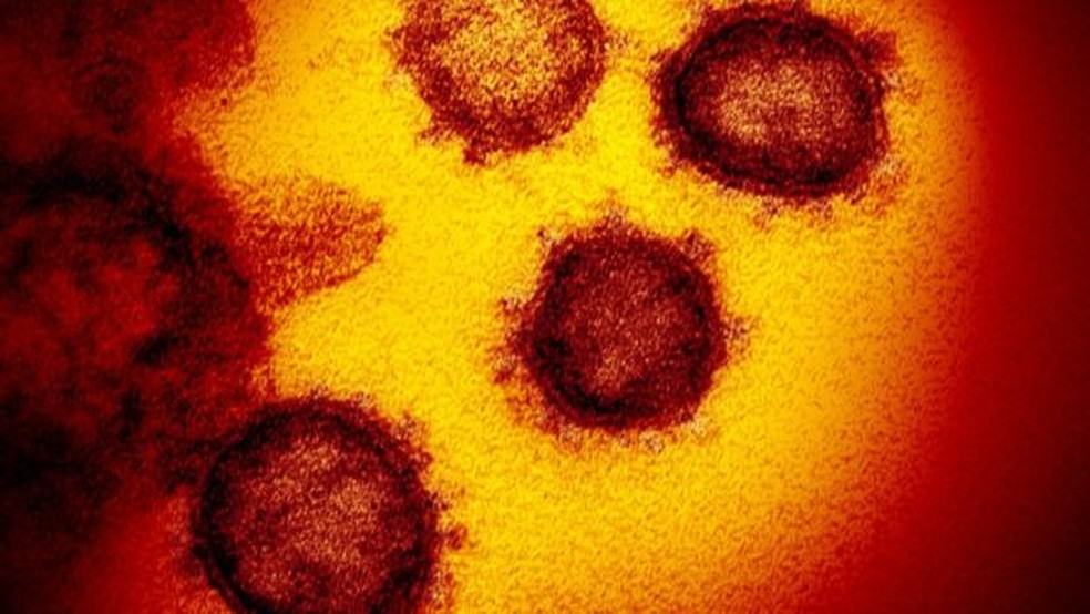 O Sars-Cov-2 utiliza proteínas em forma de espinho para aderir às células humanas que ataca — Foto: GETTY via BBC