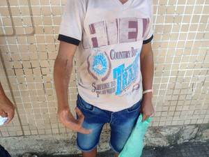 Adolescente que perdeu dedos busca pedido de auxílio no INSS (Foto: John Pacheco/G1)