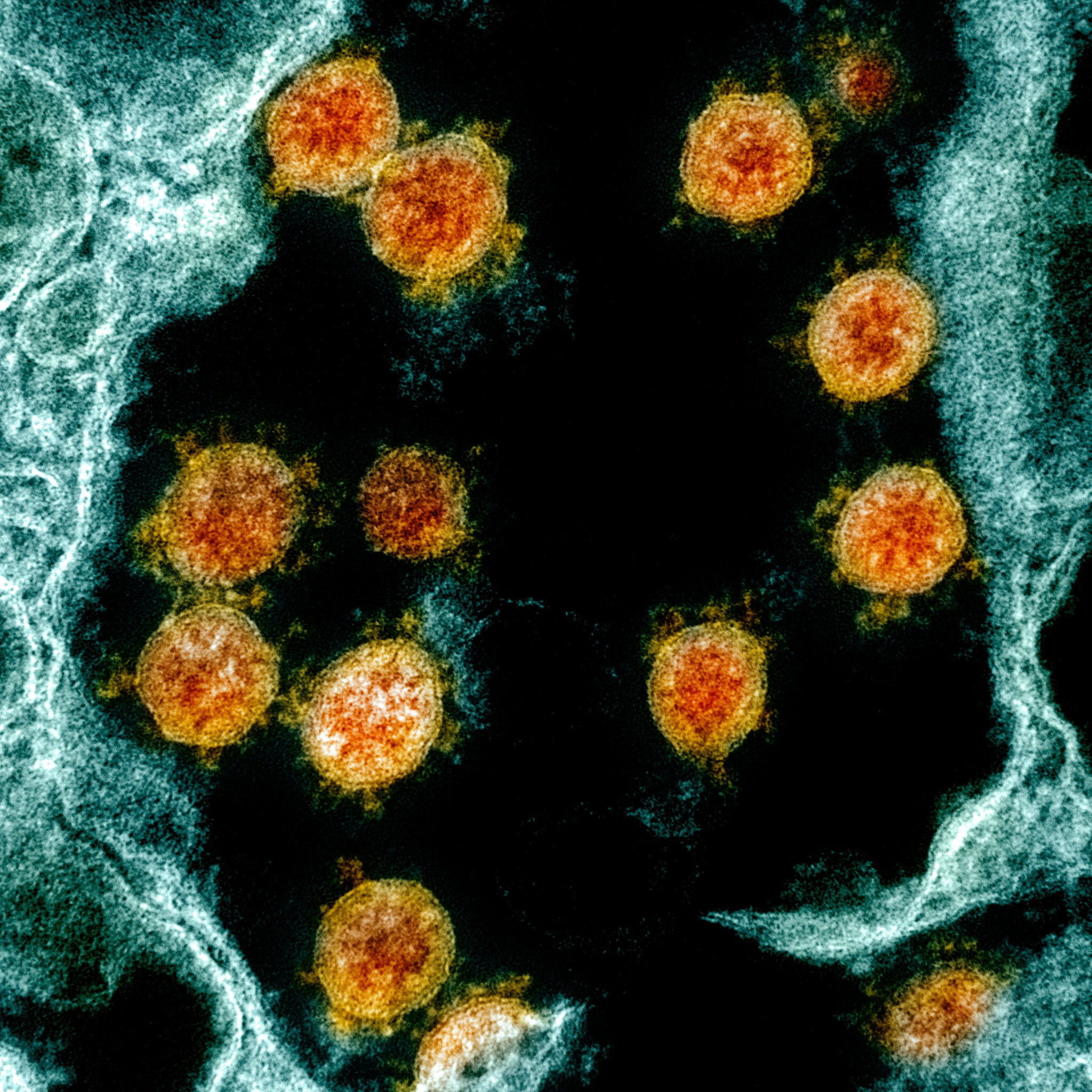 coronavirus sars-cov-2 covid-19 (Foto: NIH/NIAID)