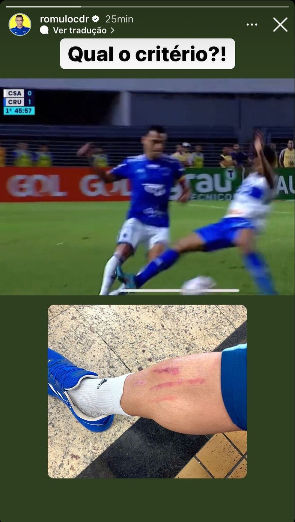 Rômulo, do Cruzeiro, mostra canela machucada após entrada de jogador do CSA — Foto: Reprodução