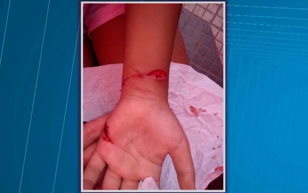 Criança foi atacada por capivara em Itabuna, na Bahia (Foto: Reprodução/TV Santa Cruz)
