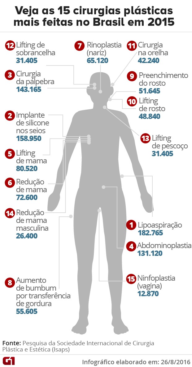 Infográfico - Cirurgias plásticas mais feitas no Brasil em 2015 (Foto: G1)