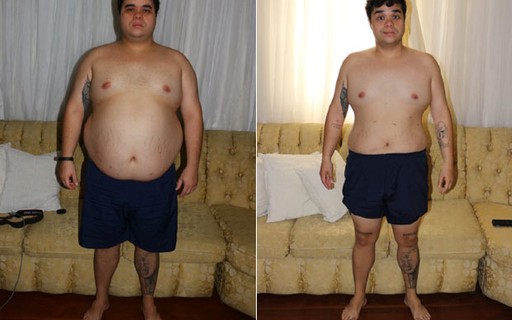 Ex-BBB Jorginho Doda elimina 30 kg após cirurgia bariátrica; veja antes e depois