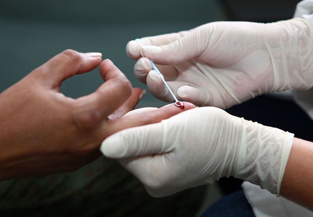 Aids - teste - HIV (Foto: Cesar Brustolin/SMCS/Fotos Públicas)