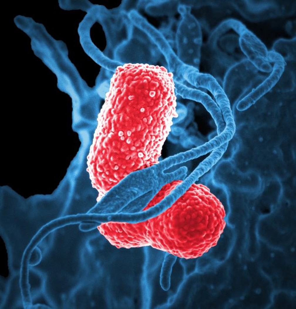 Imagem de microscopia eletrônica mostra bactéria multiresistente da pneumonia interagindo com uma célula de defesa humana  (Foto:  Instituto Nacional de Alergia e Doenças Infecciosas (NIAID)/EUA)