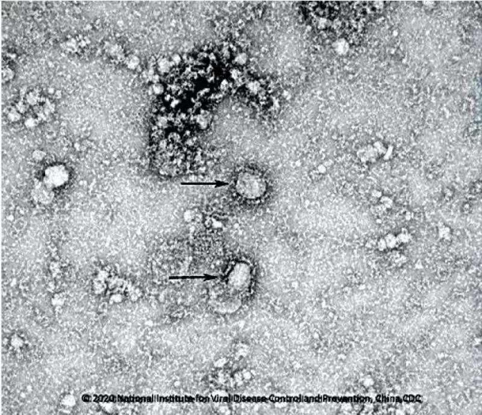 Imagem de pesquisa sobre o coronavírus — Foto: Centro de Controle e Prevenção de Doenças da China