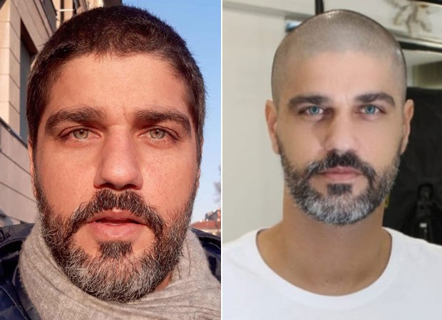 Bruno Cabrerizo antes e depois de passar máquina zero no cabelo (Foto: Divulgação)
