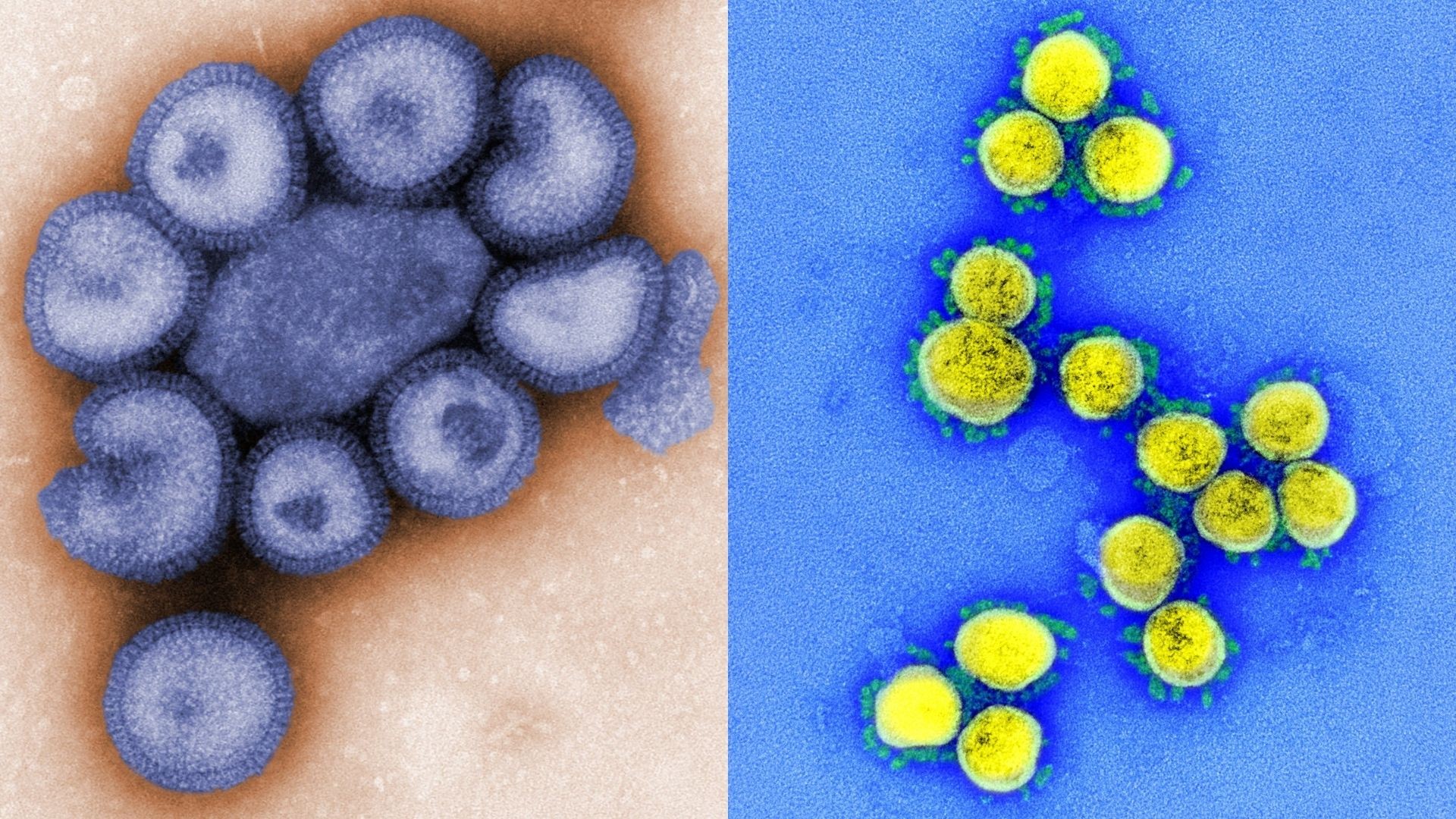 Israel confirmou seu primeiro caso simultâneo de gripe e Covid-19  (Foto: NIAD)