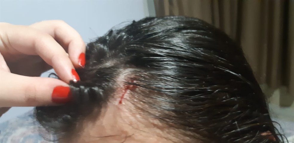 Jovem foi atingida por latinha e ficou ferida — Foto: Divulgação