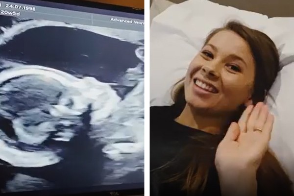 Bindi Irwin mostrou o ultrassom de sua primeira filha (Foto: Reprodução / Instagram)