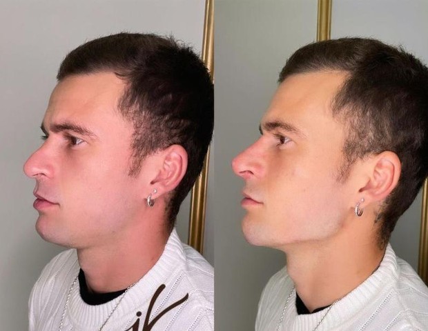 Antes e depois de Lucas Lima (Foto: Reprodução/Instagram)