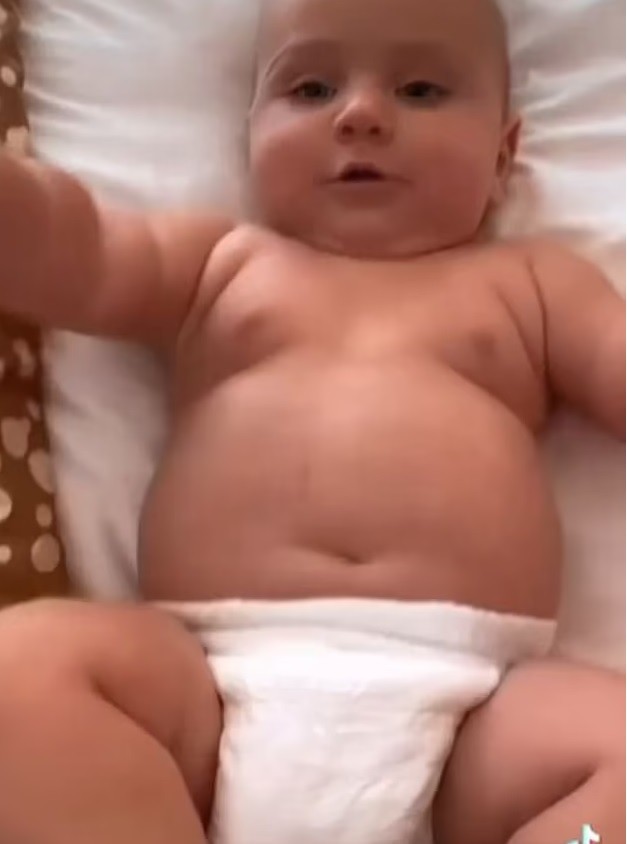 Bebê de 1 ano tem 16 kg  (Foto: Reprodução Daily Mail )