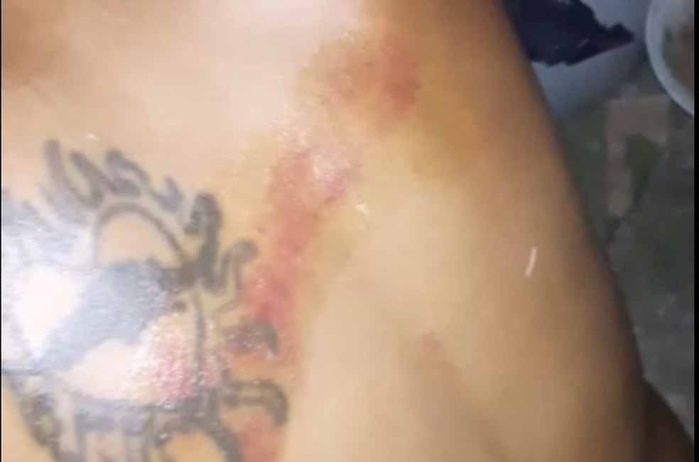 Marcas de agressÃµes foram encontrada no corpo da vÃ­tima. â€” Foto: DivulgaÃ§Ã£o/SSPDS