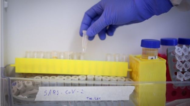 BBC - Amostras de coronavírus em laboratório da UFRJ; testagem ampla da população é condição fundamental para monitorar a doença (Foto: ANDRE COELHO/GETTY IMAGES)