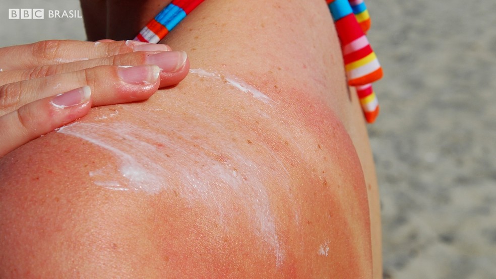Use protetor solar para evitar câncer de pele, o que mais atinge os brasileiros (Foto: BBC)