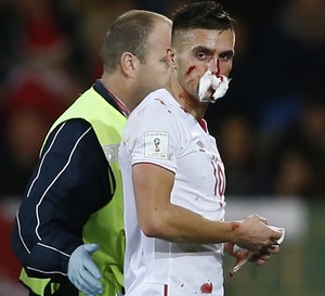 Tadic com o rosto cheio de sangue depois de sofrer um chute de Taylor em País de Gales x Sérvia (Foto: Reuters / Matthew Childs)