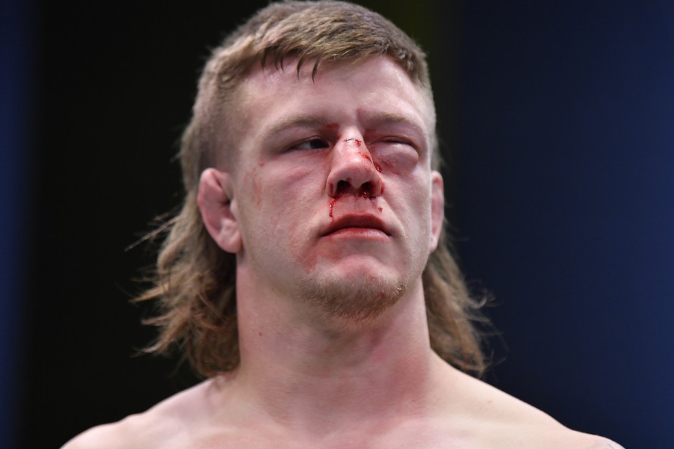 Jimmy Crute ficou com o olho esquerdo totalmente fechado após a derrota para Jamahal Hill no UFC Font x Aldo — Foto: Getty Images