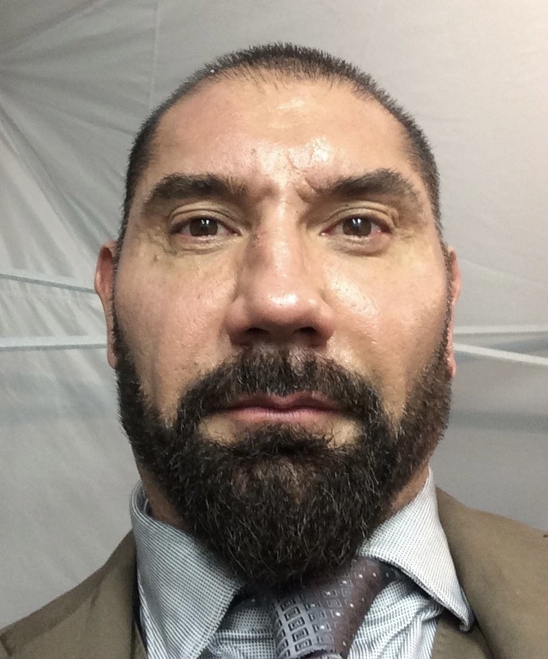 Dave Bautista com o nariz quebrado após soco de Daniel Craig no set de 007 Contra Spectre (2015) (Foto: Twitter)
