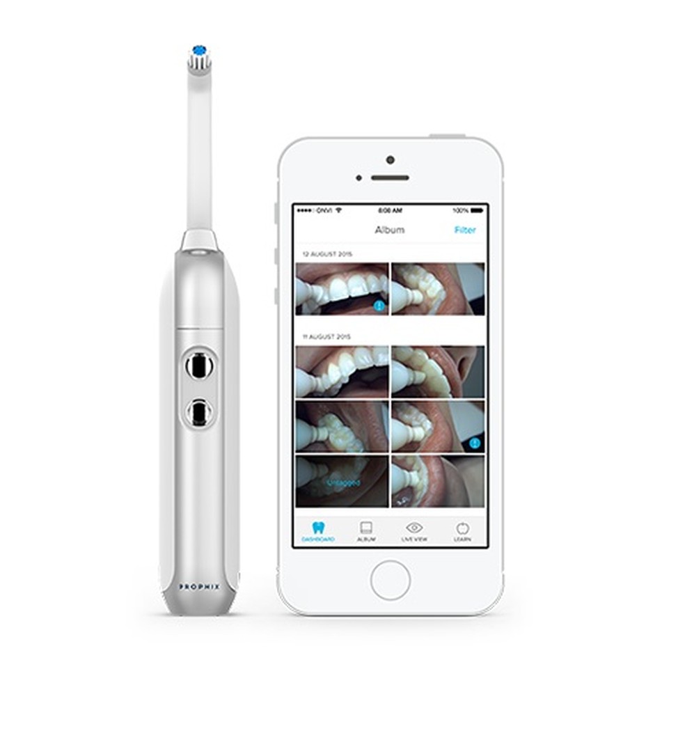 Agora é possível assistir como estão seus dentes durante a escovação (Foto: Divulgação/Onvi)