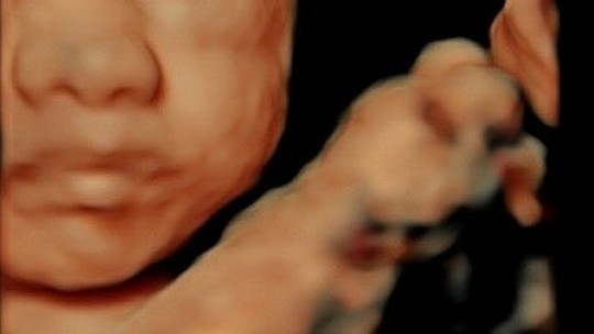 Petra Mattar mostra ultrassom do primeiro filho