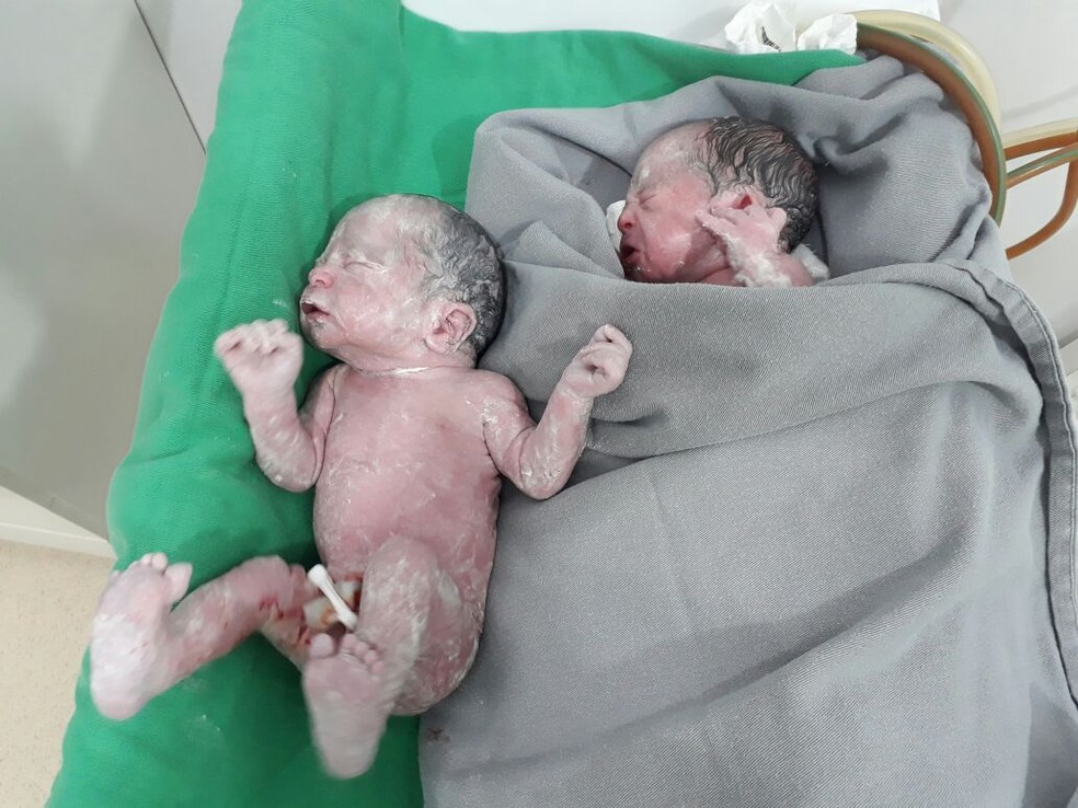 Gêmeos nasceram na madrugada desta terça-feira (3) (Foto: Rota do Oeste)