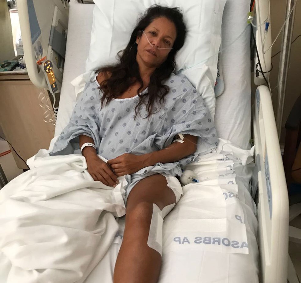 Amigos criaram uma página para arrecadar dinheiro para pagar cirurgias de Marjorie Mariano após ataque de tubarão no Havaí (Foto: Reprodução/GoFundMe)