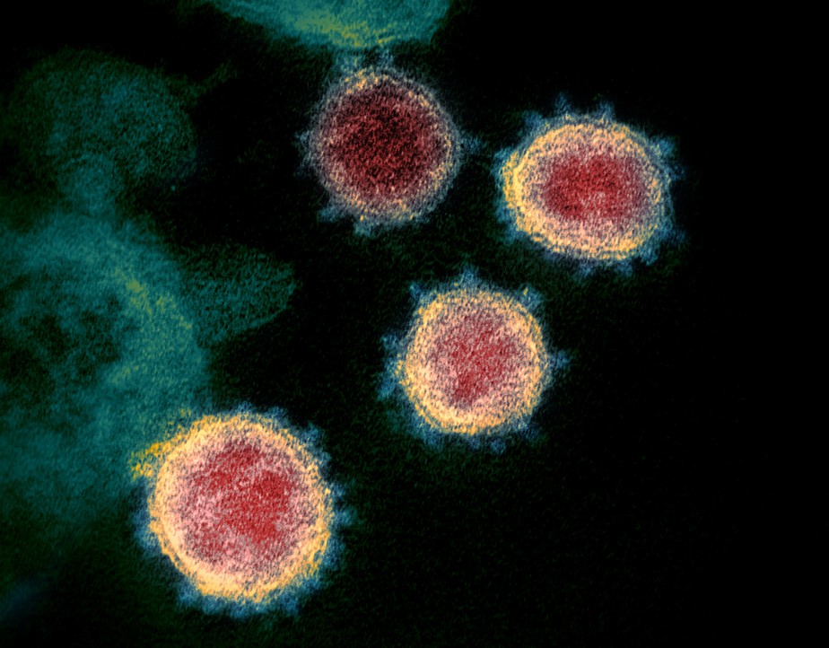 Imagem do coronavírus visto em um microscópio eletrônico.