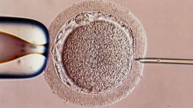 O bebê foi gerado usando uma forma experimental de fertilização in vitro (Foto: SPL, via BBC News Brasil)