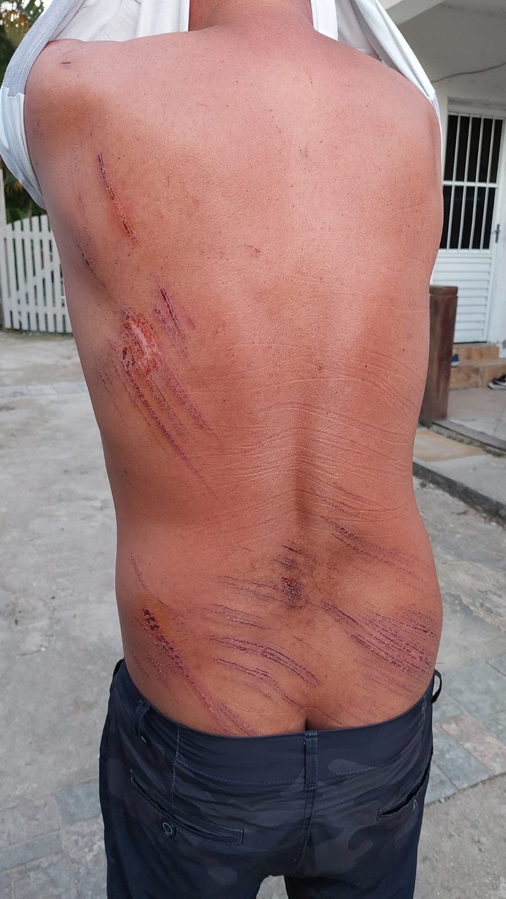 Homem ficou levemente ferido ao cair no mar e ficar isolado em ilha — Foto: Guilherme Vizane/ TV Globo 