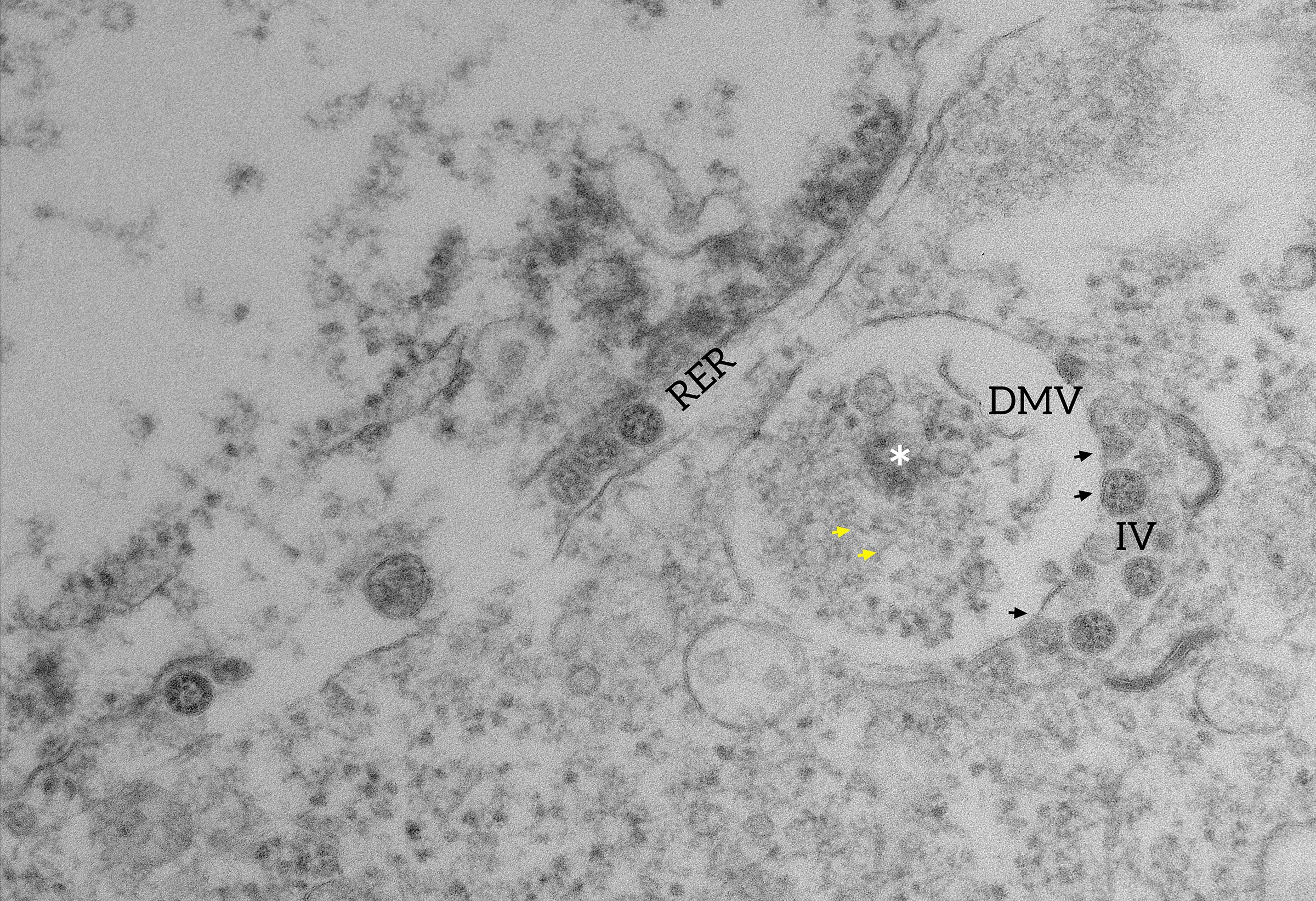 Dois compartimentos importantes para a replicação viral são flagrados nas imagens produzidas por microscopia eletrônica (Foto: Barreto-Vieira et al; Viruses)