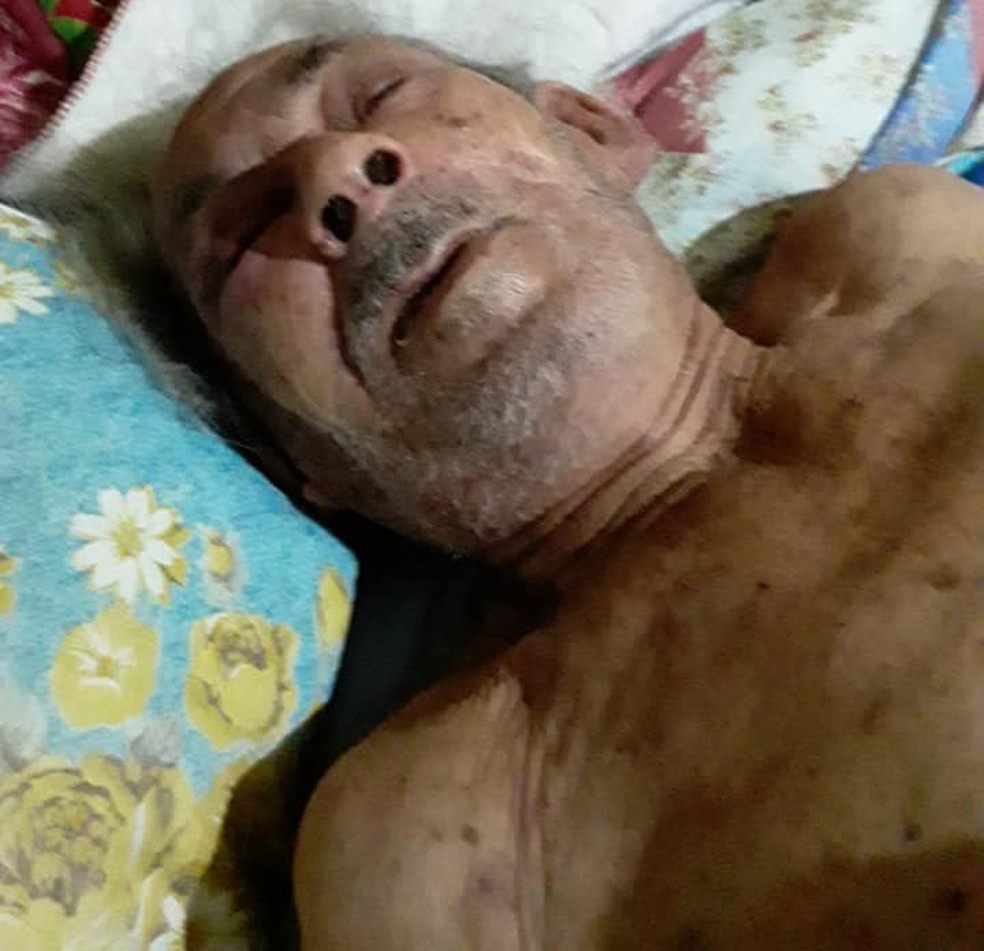 Idoso foi picado até nos lábios  — Foto: Arquivo Pessoal