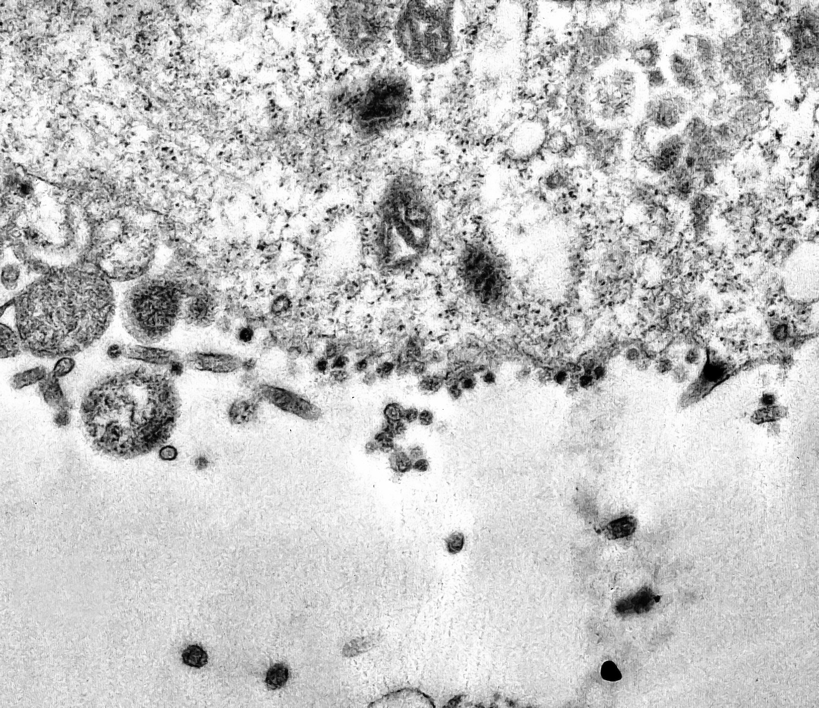 Partículas do novo coronavírus tentando infectar o citoplasma da célula (Foto: Fiocruz)