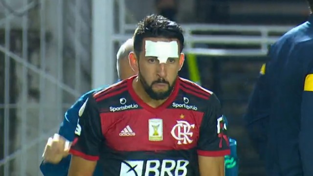 Isla, do Flamengo, com curativo após sofrer pisada na testa